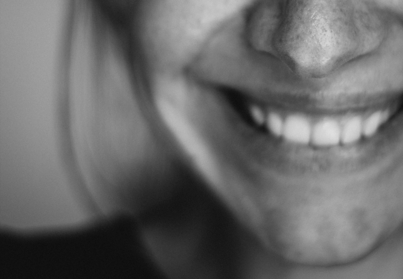 Close up of woman's face with dental implants in London