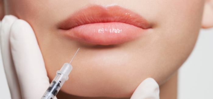 Woman with full lips getting lip fillers for added volume