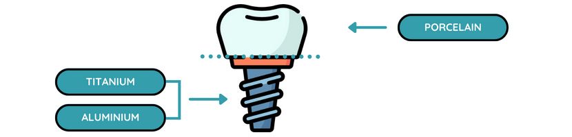 graphic showing dental implants are made from porcelain and titanium