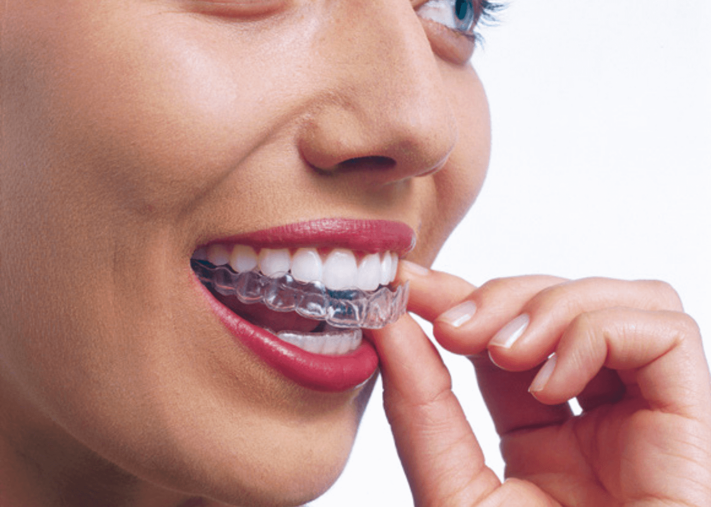 Dentist showing patient a model of straighten teeth