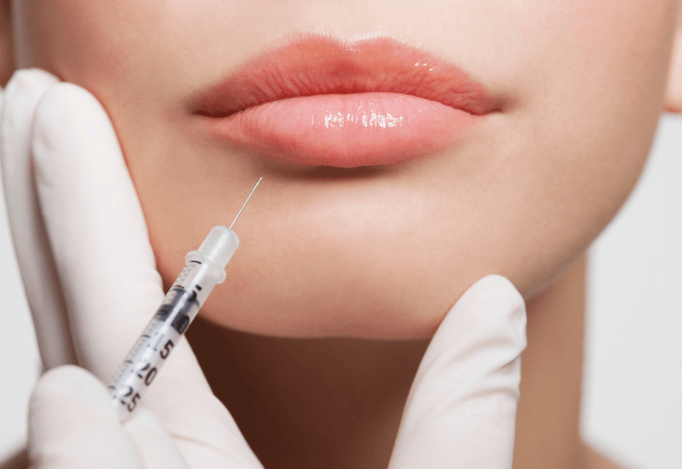 A woman receiving an anti-wrinkle injection at Crescent Lodge Dental Practice in Clapham, London