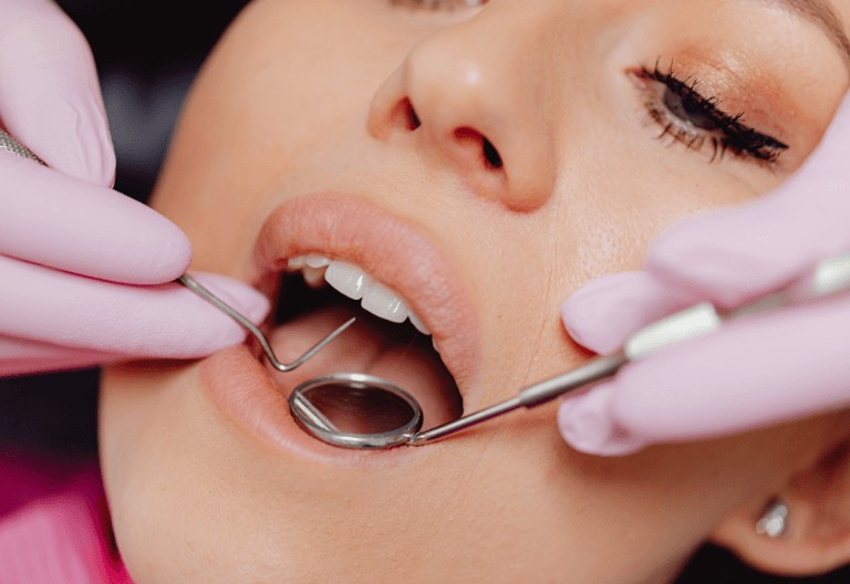 woman at the dentist receiving fillers at Crescent Lodge Dental Practice. silver fillings white fillings
