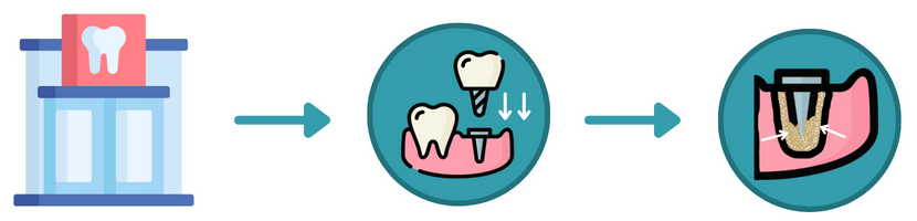 graphic showcasing the dental implant process in London 