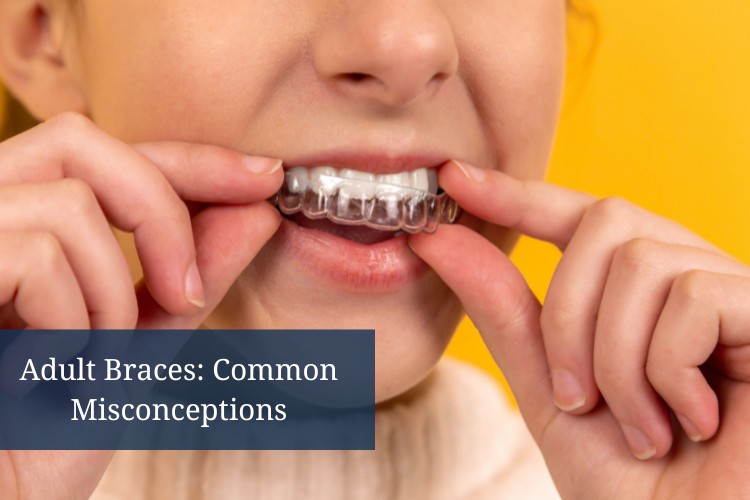 CLDP - Adult Braces Common Misconceptions