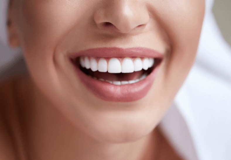 Woman with teeth grinding and clenching smiling widely