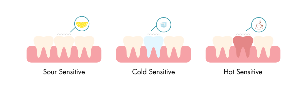 sour, cold and hot sensitivity teeth. Clapham Common dental practice