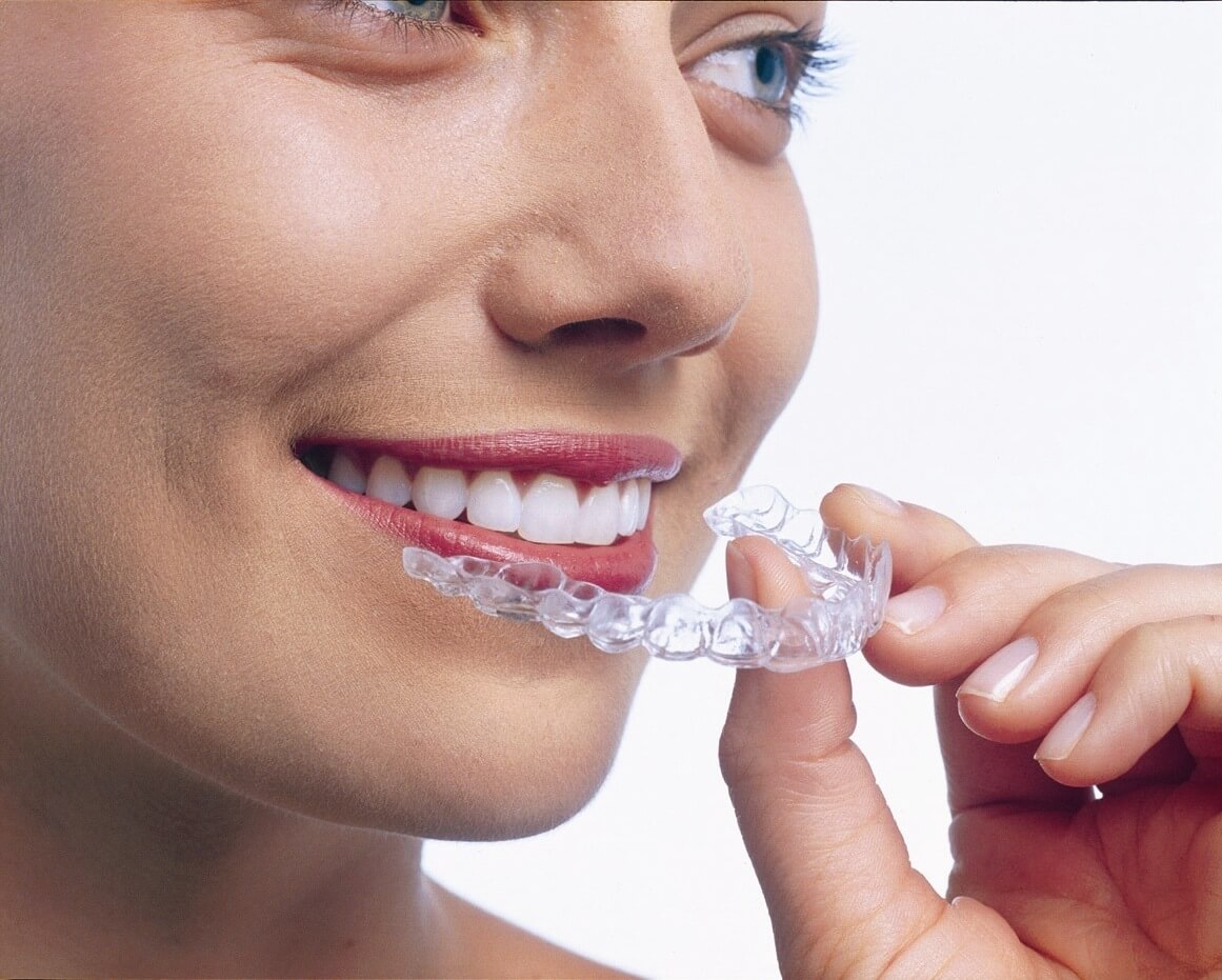 Is Invisalign Worth It?